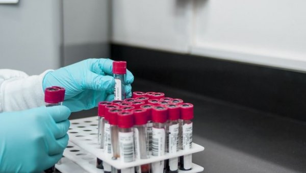 ПОНУДА МИНИСТАРСТВА НАУКЕ: Радна места у научно-истраживачким организацијама